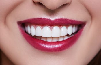 🥇 Teeth Whitening Through The Years | Carrollton, GA